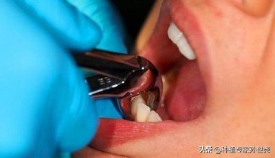 牙齿快烂完了里面疼怎么办,牙槽骨烂了牙齿要拔吗