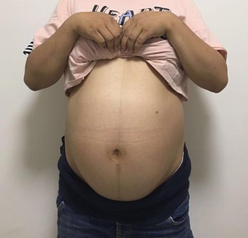 胎儿偏大一周是发育的好还是不好,胎儿偏大是因为受孕早吗