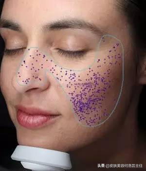 visia皮肤检测仪,visia皮肤检测报告数值越大越好吗