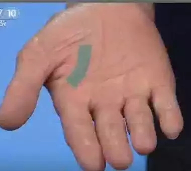手上7个小细节竟然暗藏大健康,手诊10种常见病从手上就能看出来
