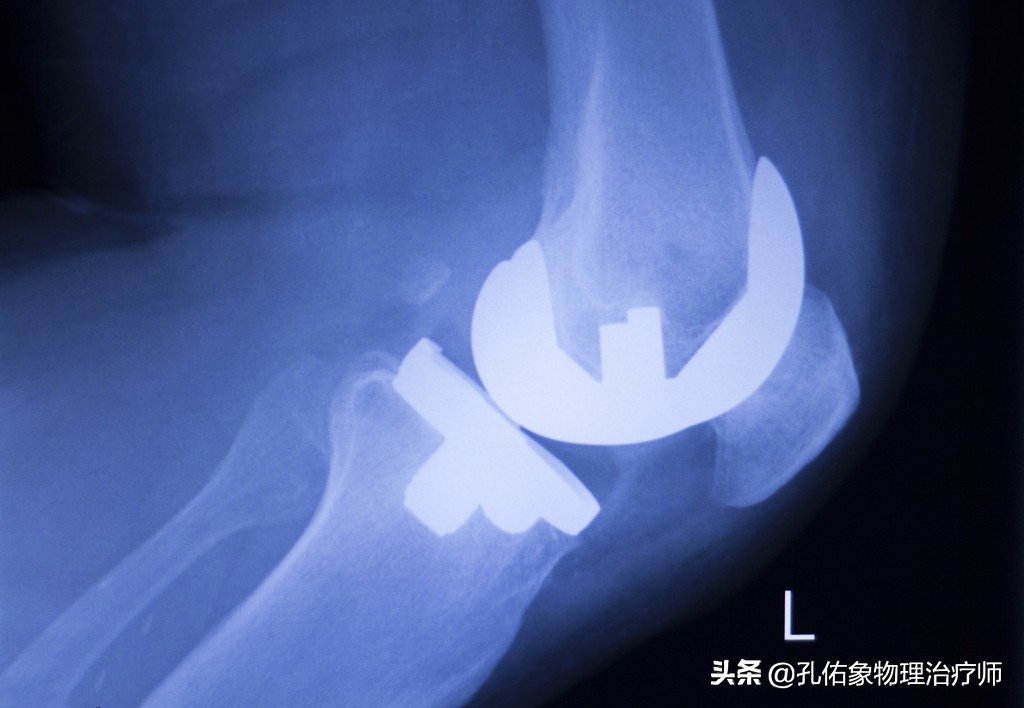 膝关节痛骨性关节炎的治疗方法,膝骨性关节炎的手法治疗视频