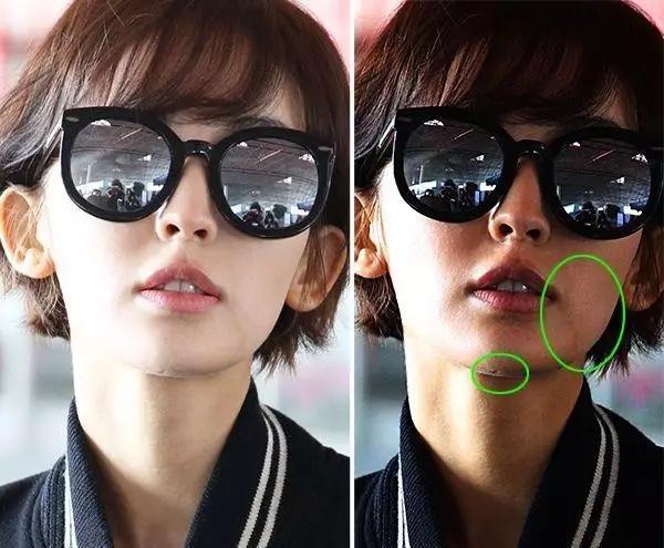 原来娜扎刘诗诗脸上的闭口这么严重!网传去闭口方法有没有用?