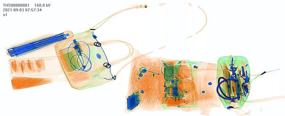 安检机操作员安全吗,安检机怎么操作呢