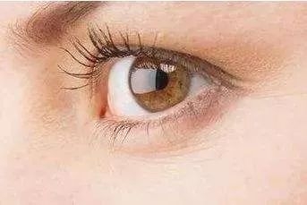 黑眼圈脂肪粒什么原因,眼部有细纹和黑眼圈的最简单方法