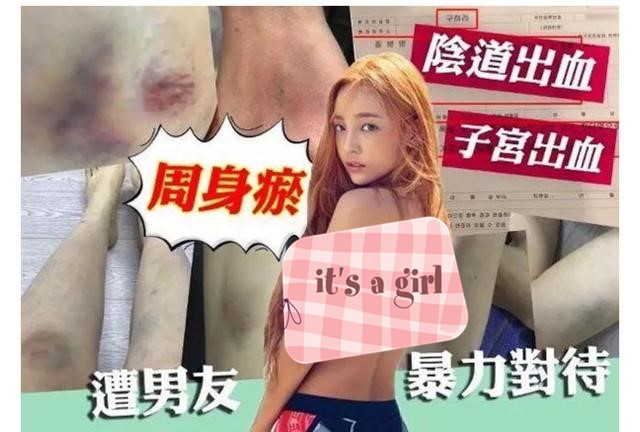 29岁韩国歌手具荷拉家中身亡,韩国女星具荷拉死亡原因调查