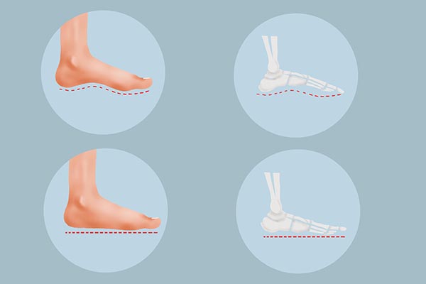 什么是筋膜炎？筋膜炎上身时，哪些地方会感觉到疼痛？