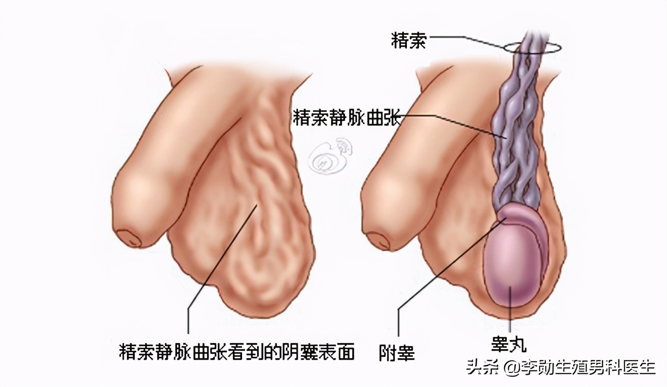 斩断三千烦恼丝英语,斩断三千烦恼丝方可破局