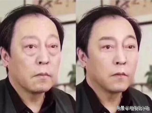 一张图分清散光和近视,眼袋和卧蚕的区分方法