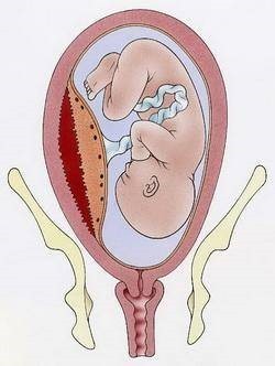 二胎妈妈每天都很难受,为什么感觉二胎假性宫缩很频繁