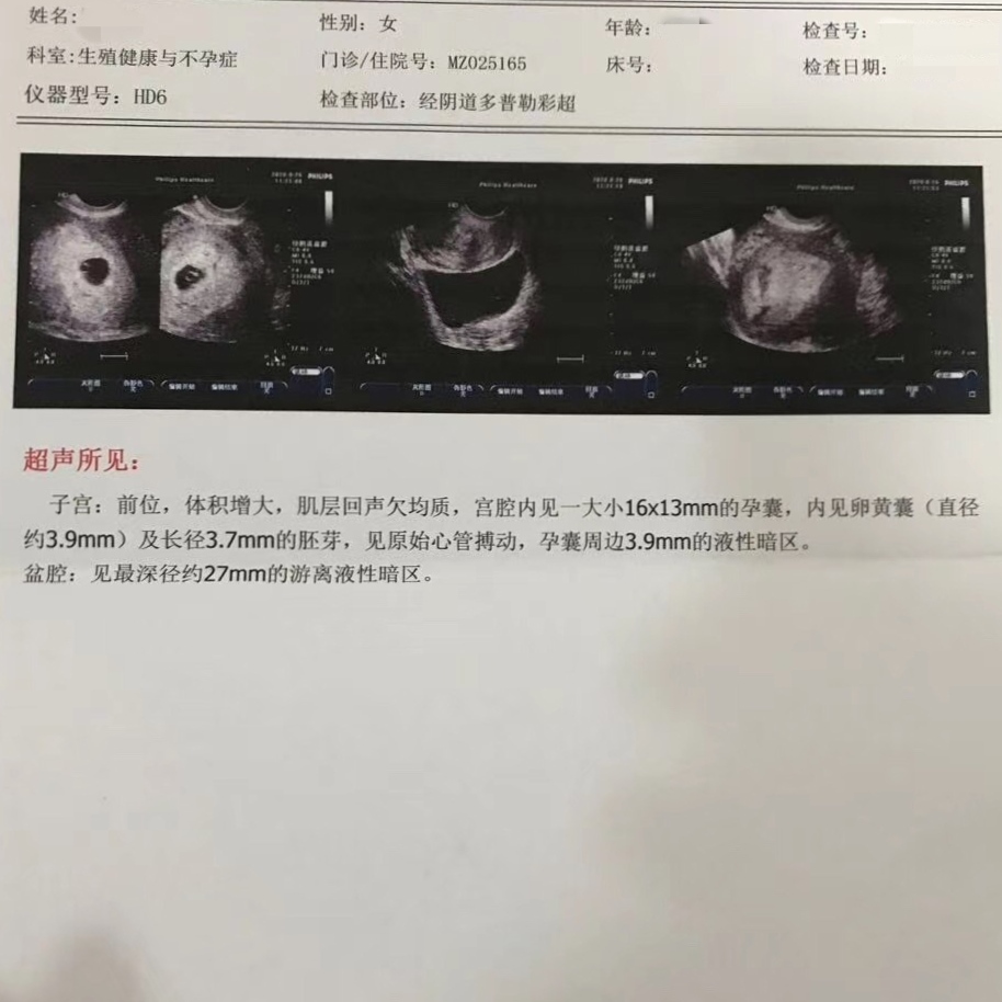 好孕分享│不孕7年，输卵管堵塞，终获好孕