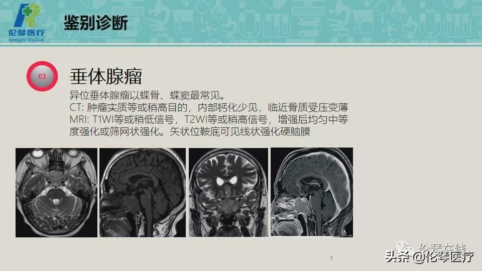 上海教授詹松华,上海曙光医院詹松华简介