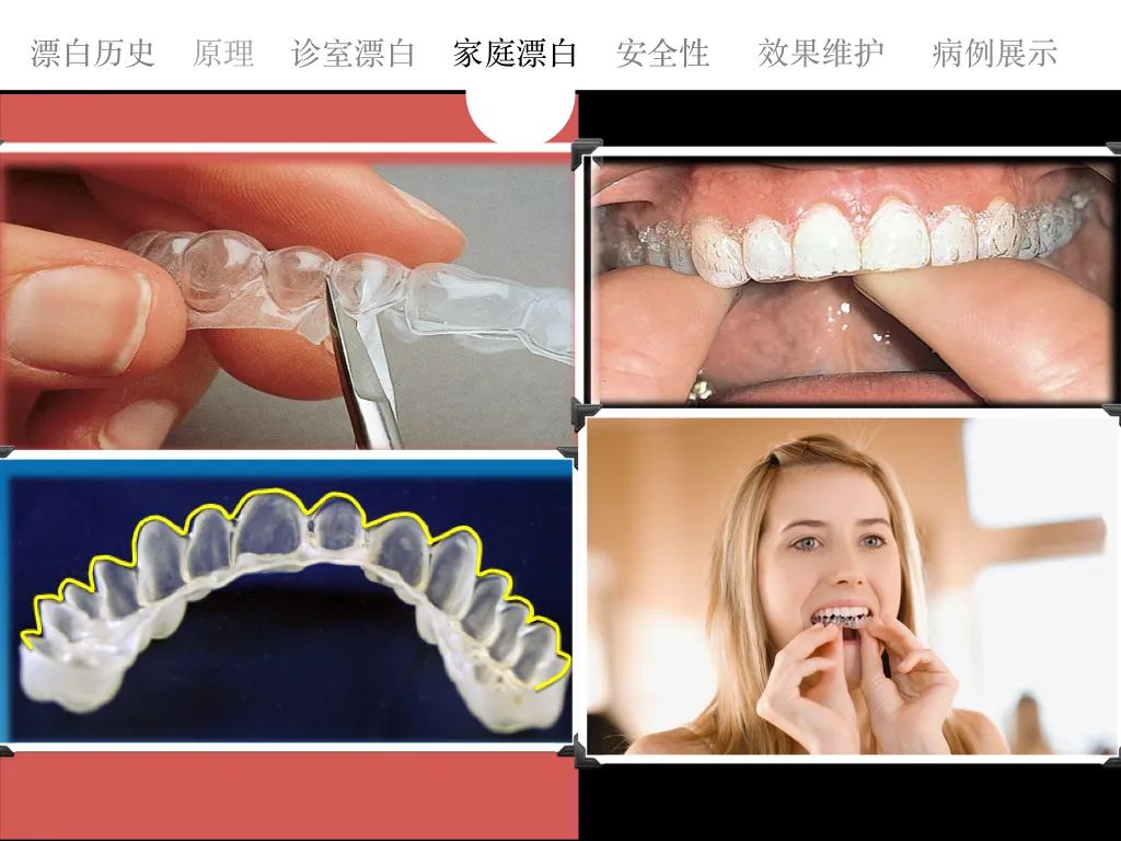 美白牙膏去牙黄真实有效测评,美白牙膏真实测评护牙效果