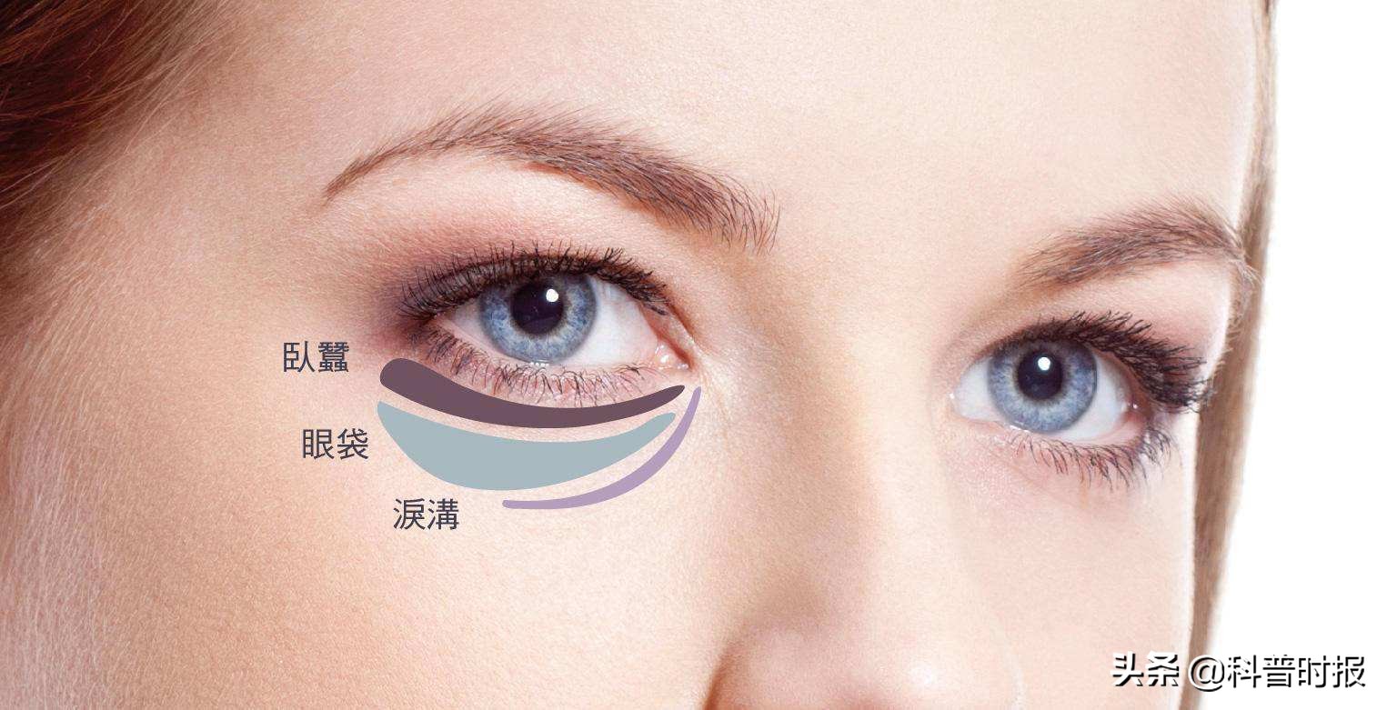【科普时报】人们对眼袋还存有不少误区