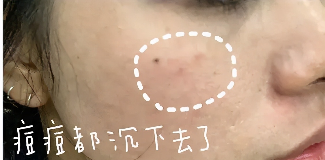 均价2元的面膜,2-3块钱一片的面膜推荐