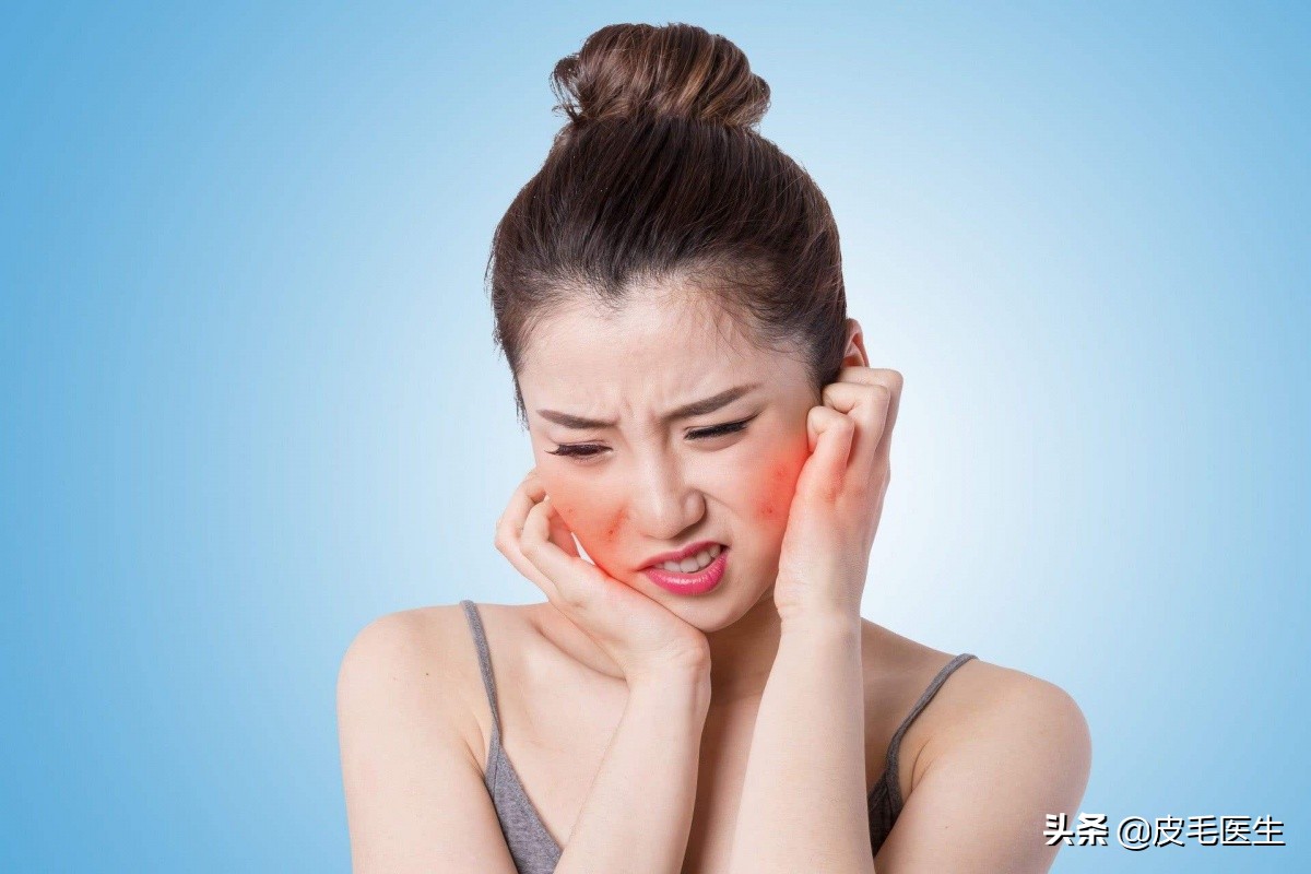 皮肤换季爆痘怎么办,皮肤换季干燥敏感爆痘怎么办