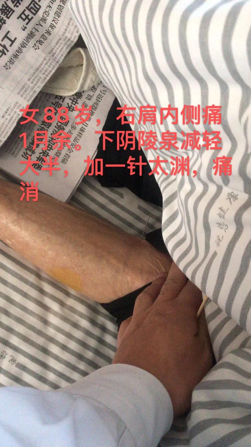 治疗房颤中医药方,房颤中西医结合提高疗效