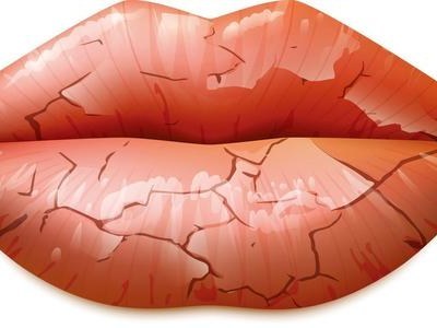 舔嘴唇会让嘴巴湿润吗,舔嘴唇嘴唇干裂怎么办