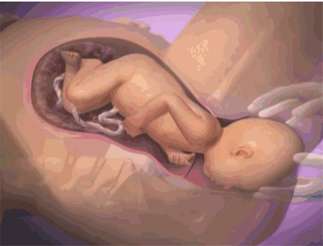 为什么说女人生孩子如同死一回,女人分娩如同鬼门关