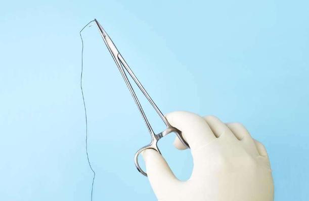 面部缝针后怎么才能不留疤,孩子脸上缝针留疤怎么祛除