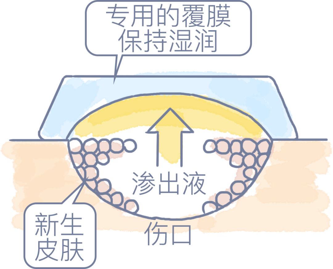 伤口结痂了是好是坏,伤口反复结痂不愈合容易患癌