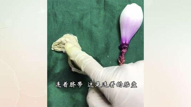 剖宫产的步骤全部过程,一颗洋葱演示剖宫产