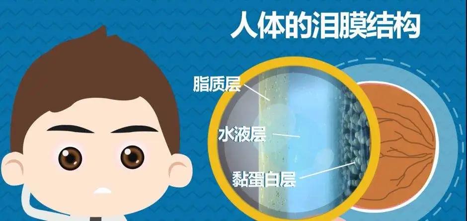 干眼症眼睛痒红血丝,干眼症眼睛起很多血丝怎么办