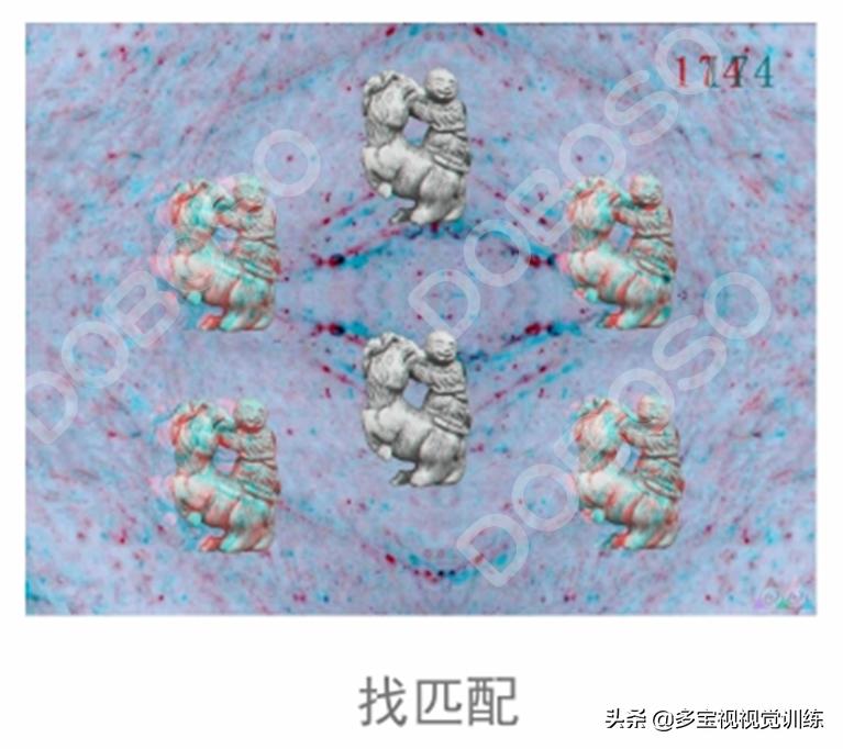 弱视单眼抑制做什么训练,弱视训练立体视是最后一步吗
