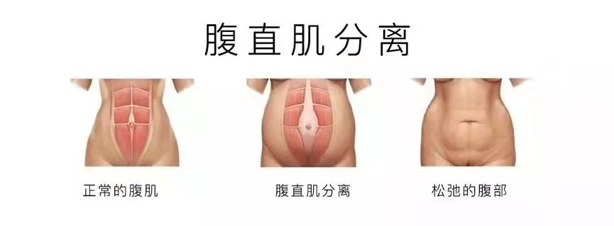 关于女性分娩话题,评论女人生娃前后的变化