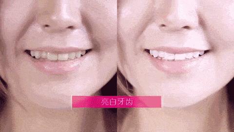 刘涛同款烤瓷牙,刘涛的牙齿烤瓷牙和全瓷牙