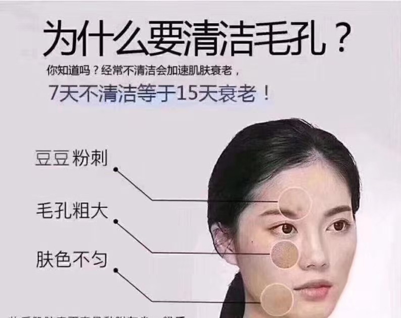 名门泽佳清痘补水,名门泽佳油皮怎么护肤