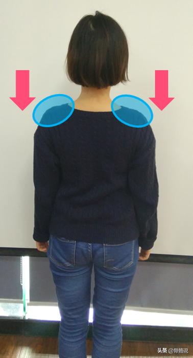 怎么预防脖子有个富贵包,脖子后的富贵包真是夺命包