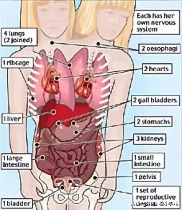 罕见双头连体人能活多久,诡异的双头生物