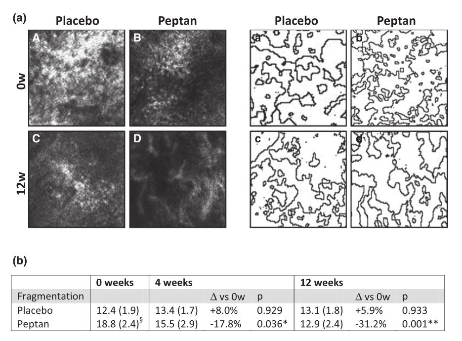 喝的胶原蛋白饮是智商税吗,胶原蛋白到底是智商税还是真补品