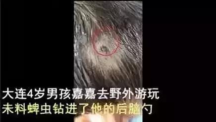 夏天最要小心这四种虫子,在外面遇到这种虫子千万别用手拍