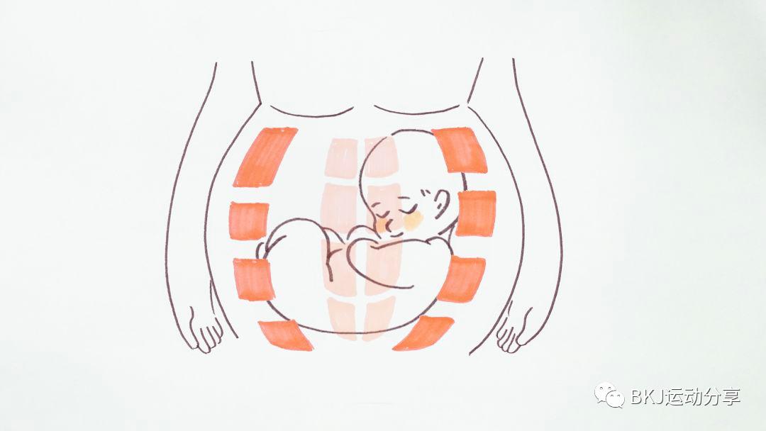 宝妈腹直肌分离肚皮松垮,产后妈妈腹直肌分离是怎么回事