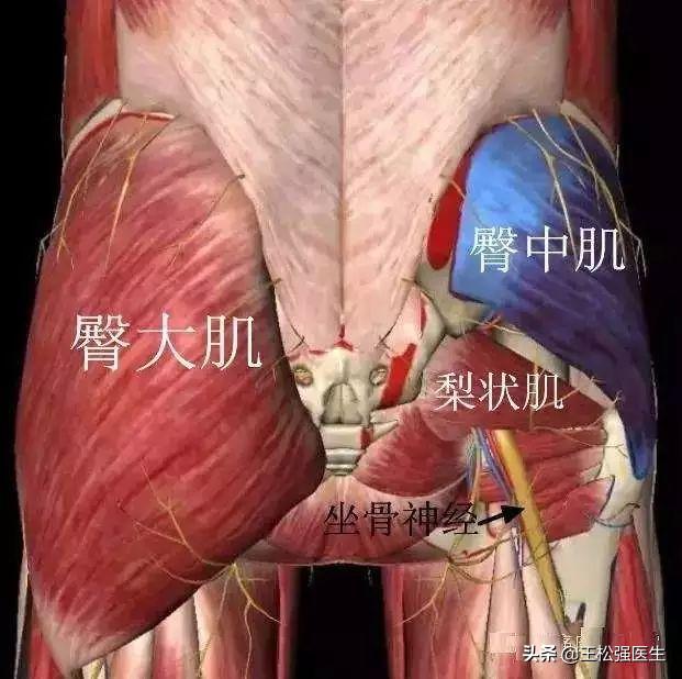 腰4-5椎间盘突出最好的治疗方法,不是所有的腰痛都是腰间盘突出