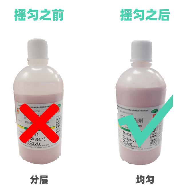 皮肤发痒抹炉甘石就好什么原因,皮肤痒擦炉甘石有用吗
