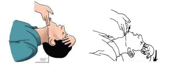 多发伤的诊断和处理原则,如何实施多发伤的急救处理