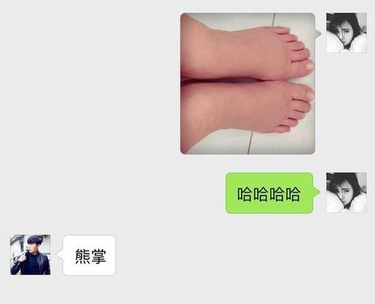 35周脚肿得像个猪蹄一样怎么缓解,孕晚期脚肿得像猪蹄怎么缓解