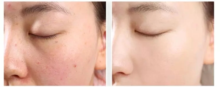 14款气垫合集！一篇解决干皮、油皮所有问题！