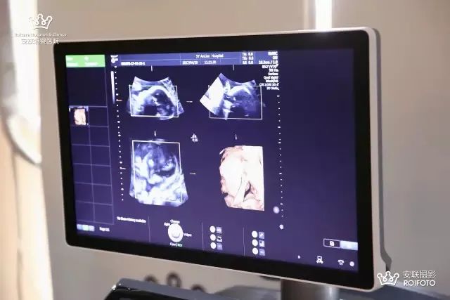 孕期检查做几次四维彩超,孕期产检需要做几次肝胆彩超