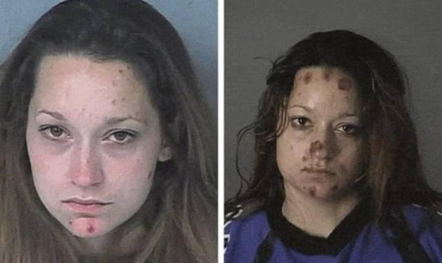 吸笑气吸到大小便*禁失**、把亲妈鼻梁打断....被*品毒**彻底毁掉的年轻人