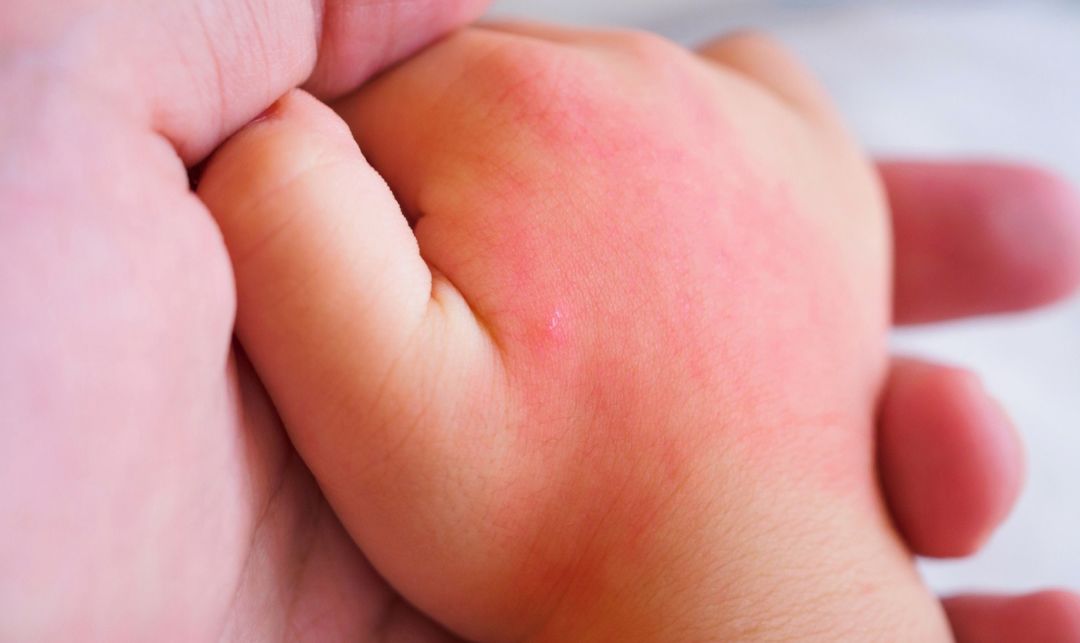 酒精消毒液怎么使用才正确,酒精消毒液的使用方法是什么