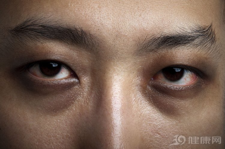 遗传代谢性肝病转氨酶升高特点,体内转氨酶