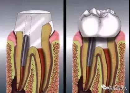 小小牙齿,小小牙齿矫正