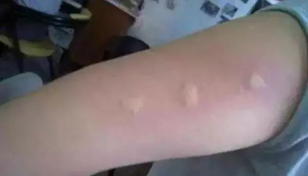 灭蚊神器怕蚊子的人赶紧入手吧,日本户外灭蚊器