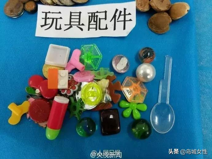 8岁男孩误吞5厘米钢钉,惊险9岁男孩误吞3厘米图钉