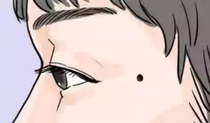 黑痣要除掉挂什么科,黑痣预防性去除有必要吗