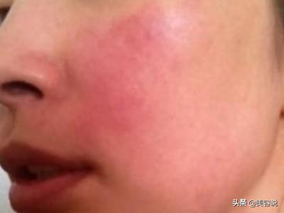 空调暖气干燥如何保湿,冬天空调房太干燥怎么办