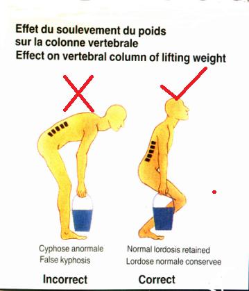腰椎间盘突出针灸有副作用吗,腰椎间盘突出针灸越来越严重